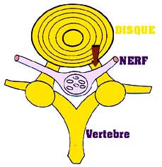 La douleur cervicale dans la tête de la raison et le traitement
